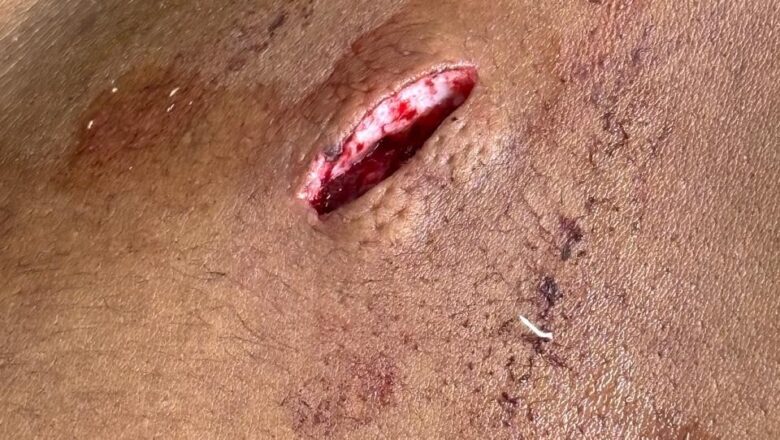 BREAKING NEWS थाना रामा मंडी के अधीन आते झंडू सिंहा में स्थित धोगड़ी गांव गोलियां और तेजधार हथियार चलने की घटना सामने आई है।